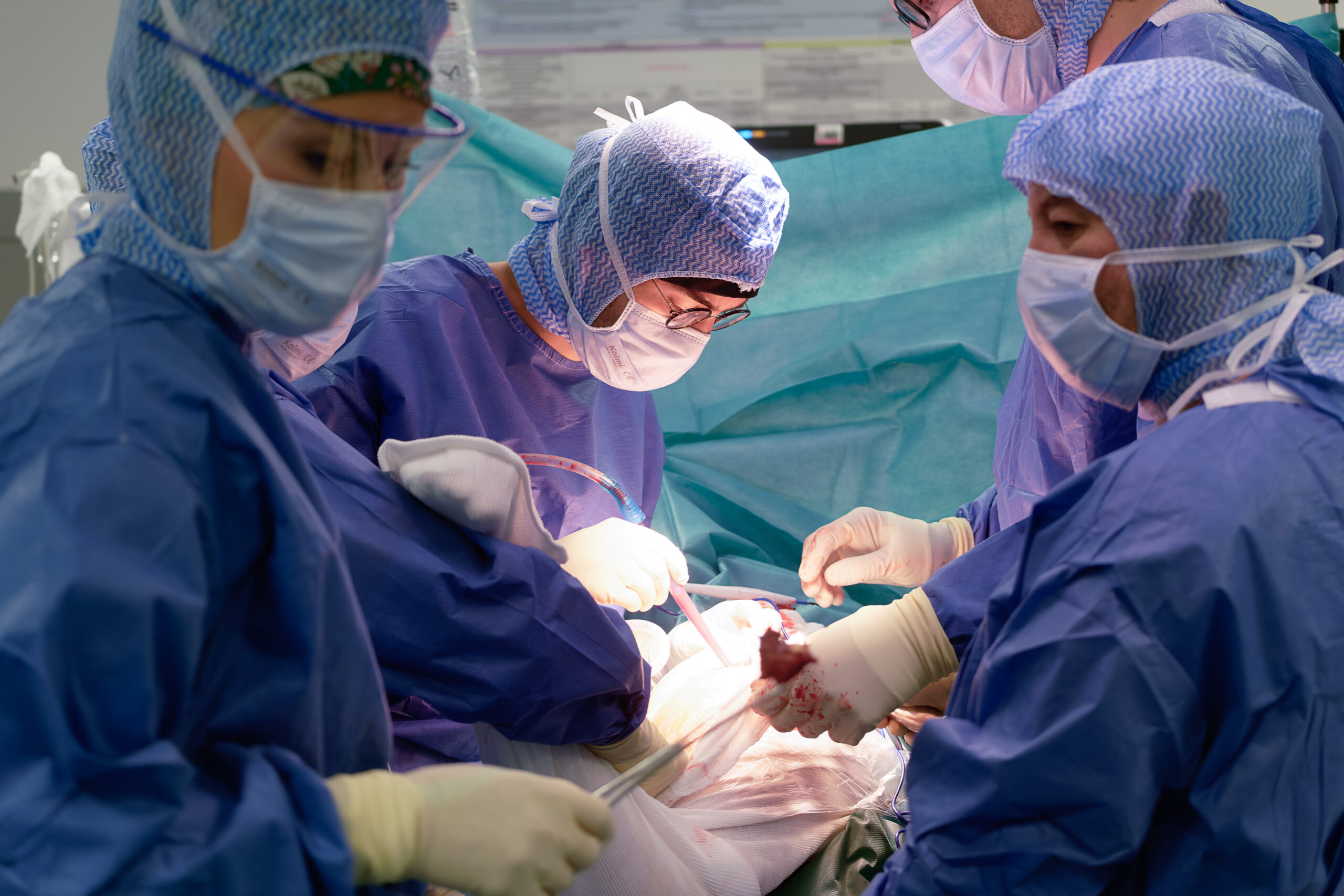 Je prpare mon intervention chirurgicale - Centre Hospitalier de Lens